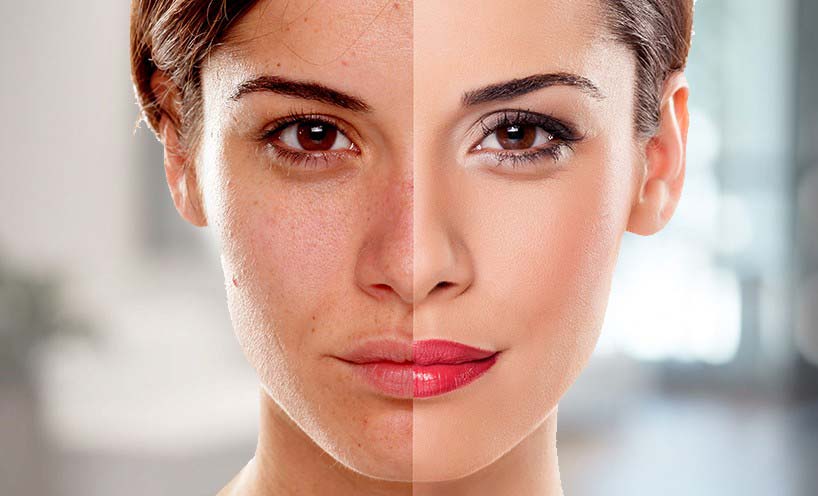 Before and after anti-aging skin results showing smoother skin, reduced fine lines, and improved firmness linked to hibiscus tea benefits.